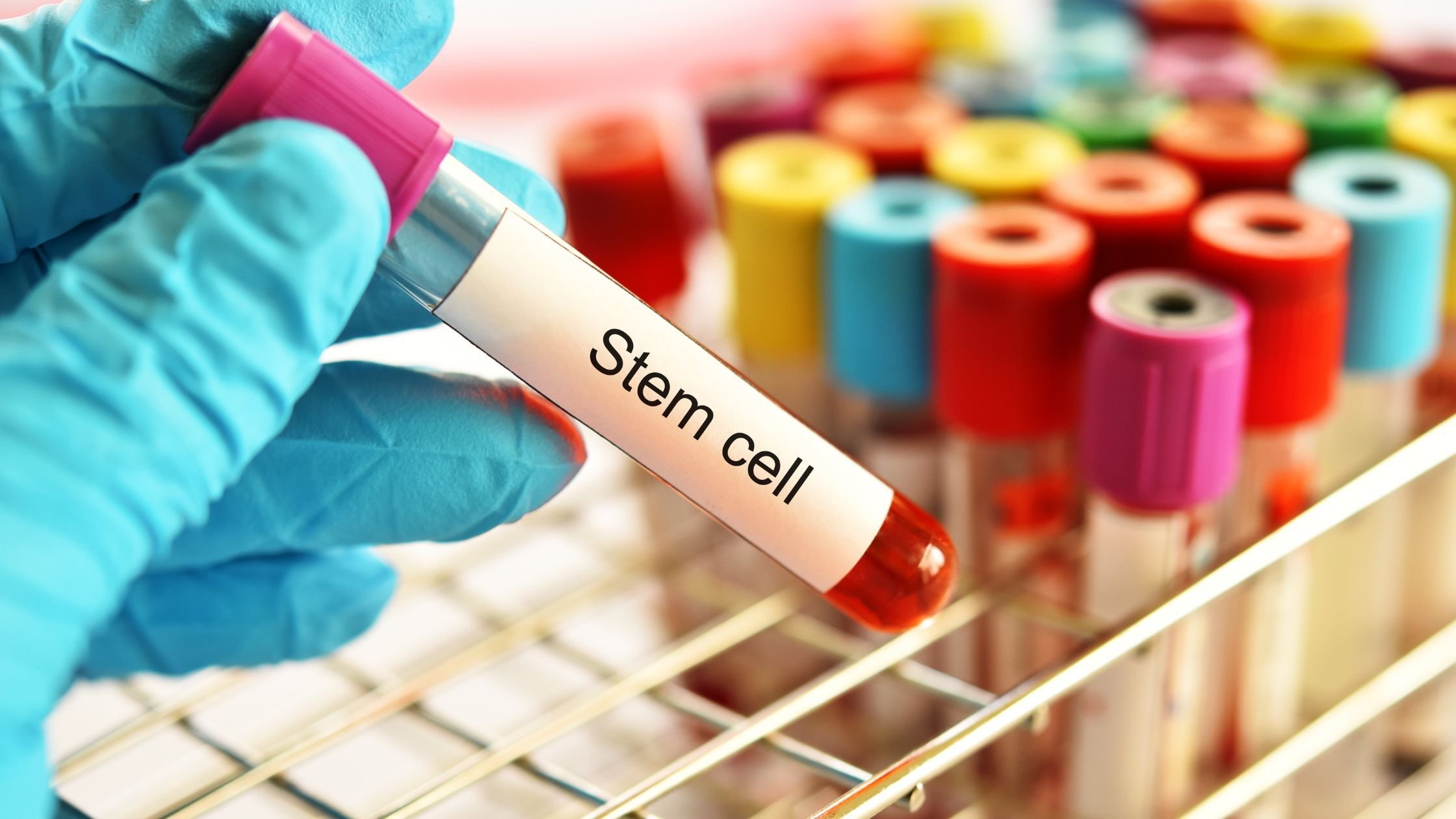 stem cell